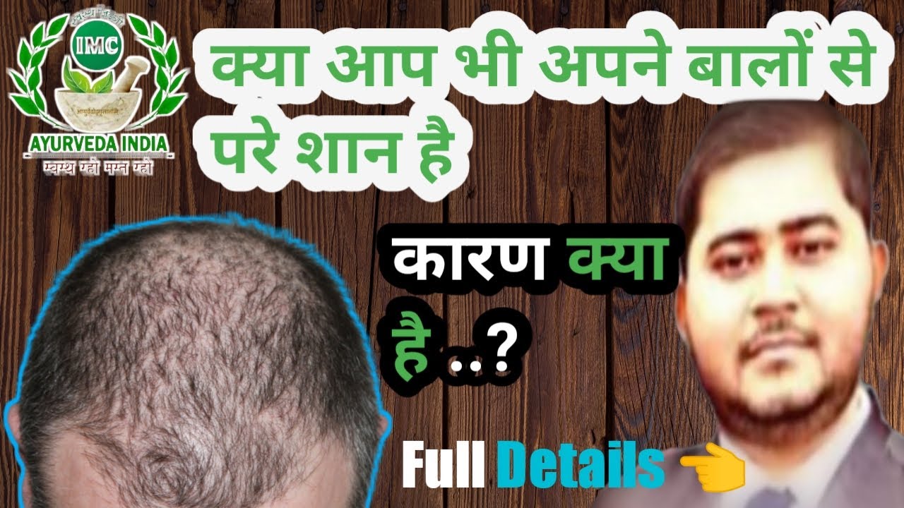 IMC Treatement for hair loss Imc treatement for hair fall causes of hair fall YouTube