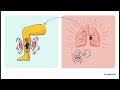 Deep Vein Thrombosis (DVT): Causes, Symptoms, Treatment, and Prevention | In Hindi | Mera Physio