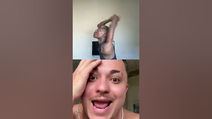 Ele quebrou o braço #shorts