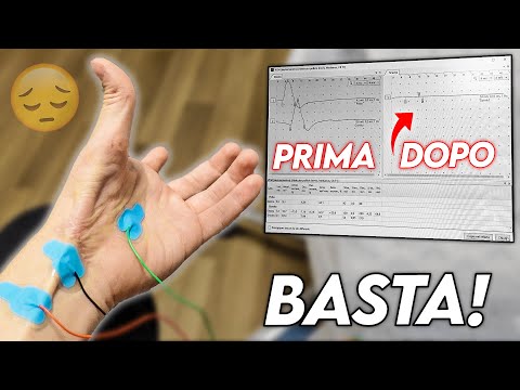 L’ULTIMA VISITA ALLA MIA MANO - è finita