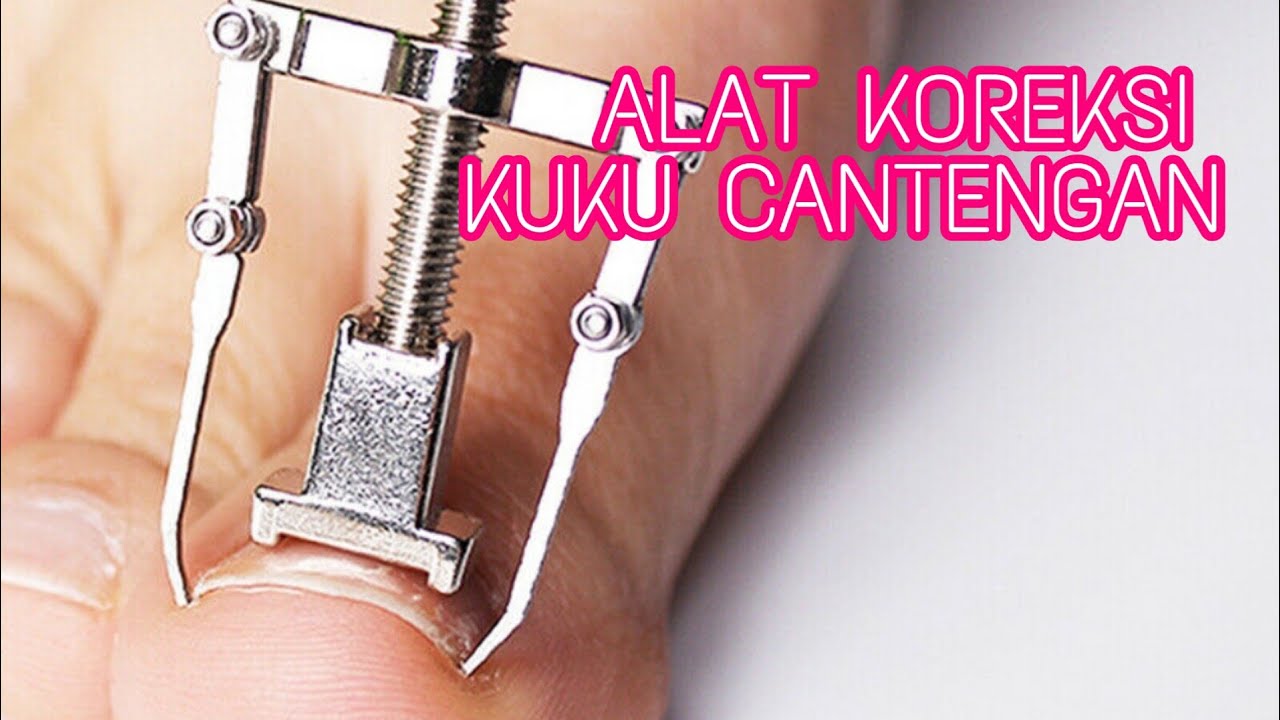 Alat Koreksi Kuku Cantengan 