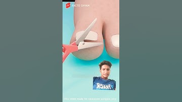 "Truth About Ingrown Nails 😨 | Explained in #shorts #facts #shortsfeed #3danimation