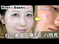 【案件❌ほぼ3000円以下】美容医療なしで圧倒的美肌になった最新スキンケアルーティン全部見せます!