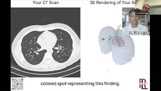 Pranav Rajpurkar - Multimodal Generative AI For Medical Image Interpretation