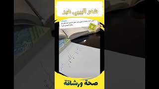 كم المدة التي يحتاجها شعر البيبي هير لنمو مع الدكتور عمار العمار