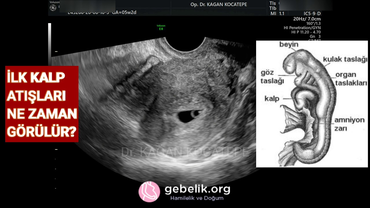 kalp atislari bebek crl olcumu kac oldugunda gorulur vajinal ultrasonda daha mi erken gorulur youtube