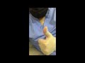 ماهي نسبة الدم الطبيعية بجسم الانسان
