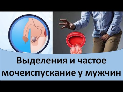 Выделения и частое мочеиспускание у мужчин