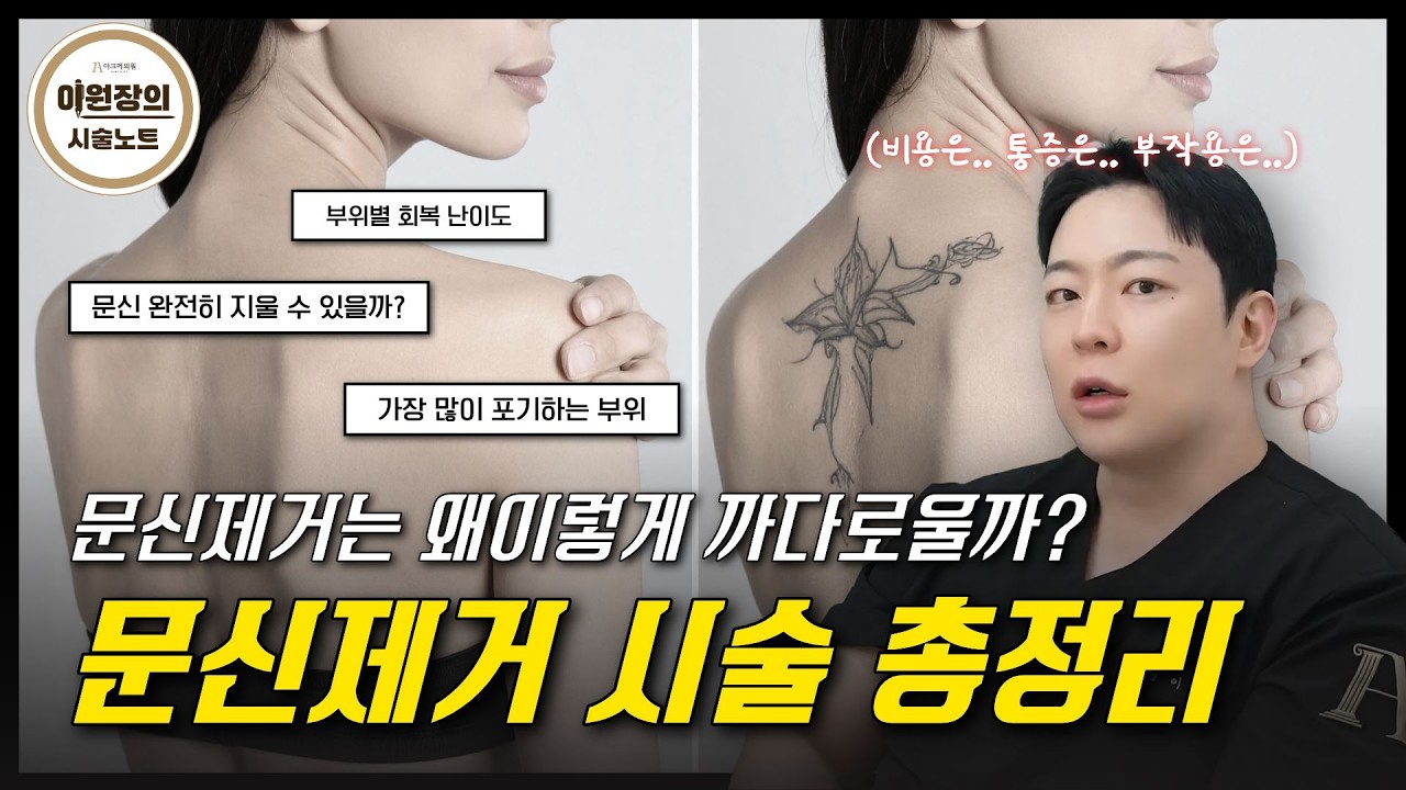  “문신하지 말걸…” 제거하다가 가장 많이 포기하는 부위ㅣ문신제거는 왜 이렇게 까다로울까?