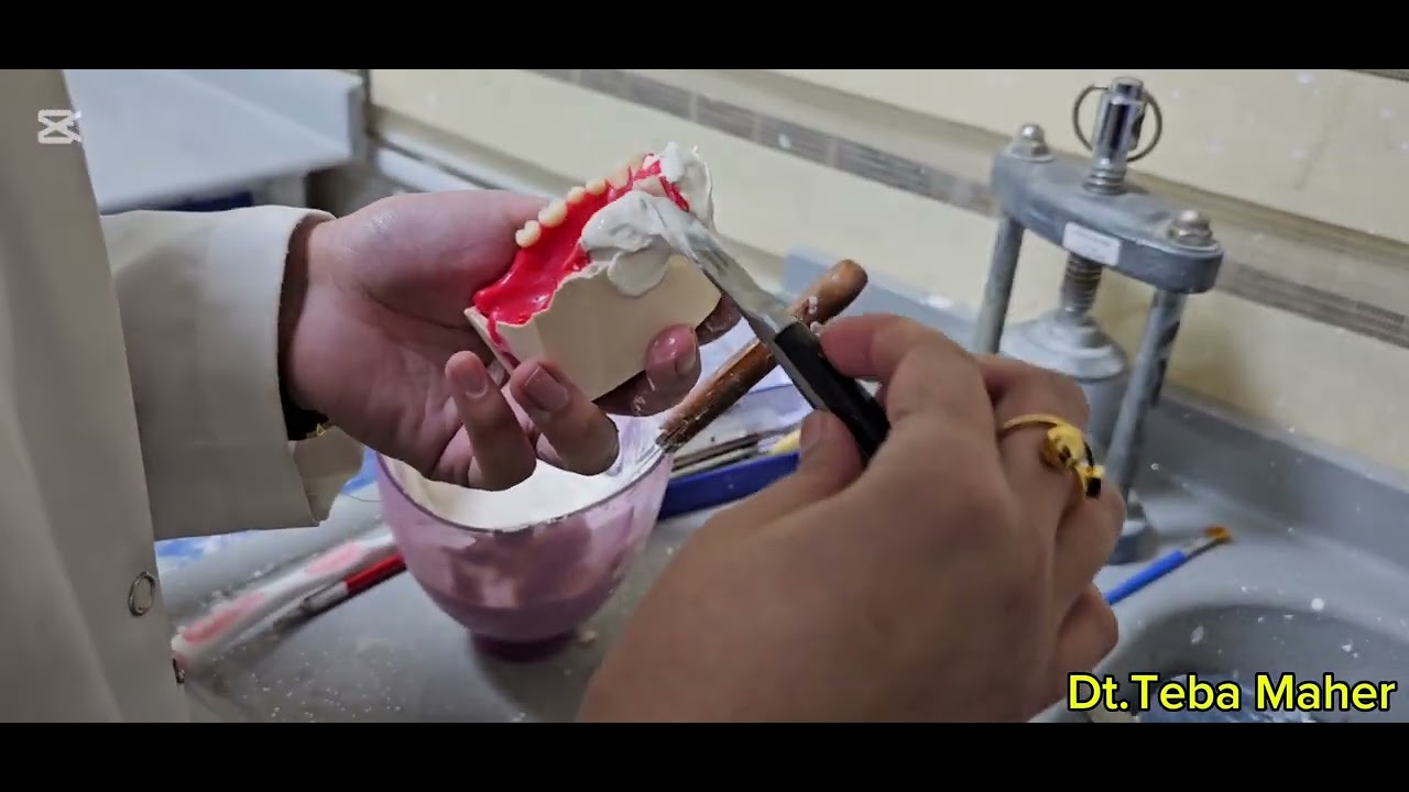 Trimming ,flasking,and wax elimination for maxillary obturator