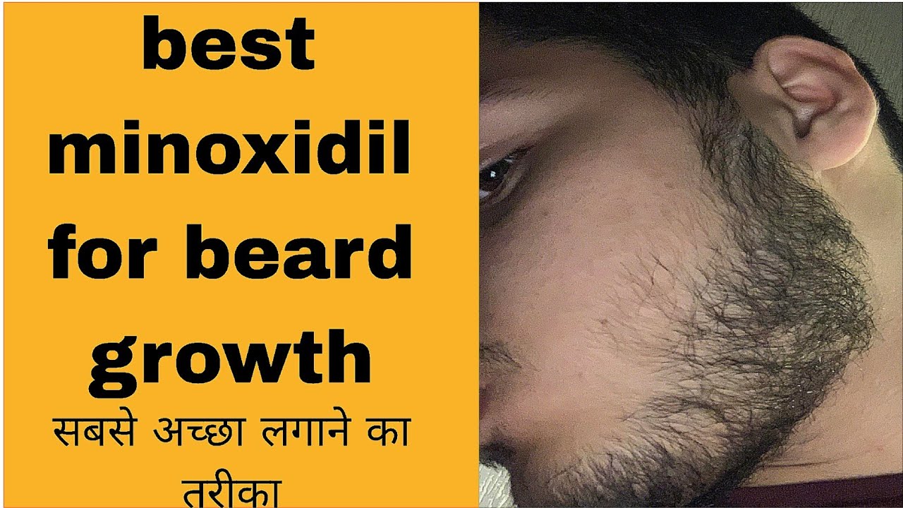 Best minoxidil for beard growth  | beard kaise ugaaye 