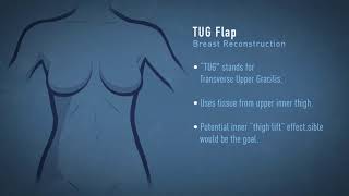 TUG Flap Breast Reconstruction Animation