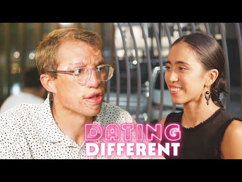 My Burns Stop Me Finding Love - Will My Blind Date Care? | DATING DIFFERENT