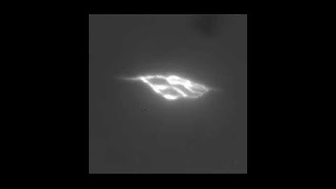 Real-time printing of a human-sized capillary using laser-based holographic 3D printing