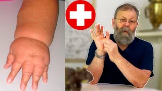 видео: ОТЁКОВ БОЛЬШЕ НЕ БУДЕТ СУЩЕСТВОВАТЬ В НАШЕЙ ЖИЗНИ! картинка: ОТЁКОВ БОЛЬШЕ НЕ БУДЕТ СУЩЕСТВОВАТЬ В НАШЕЙ ЖИЗНИ!