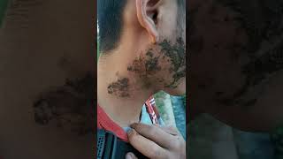 #viral tersengat ulat api langsung encook#shorts