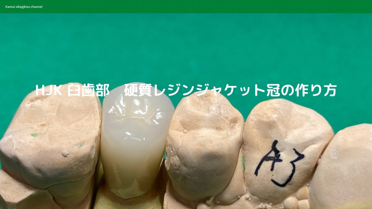 Dental technician] How to make a hard resin jacket for HJK
