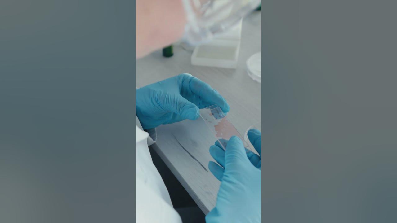 Sandoz s jubbonti wyost approved as interchangeable biosimilars to