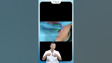 Quy trinh tháo mắc cài | Bác Sĩ Yên