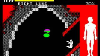 Fantastic Voyage Walkthrough, ZX Spectrum