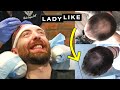 I Got A Robotic Hair Transplant • Ladylike