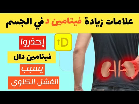 اعراض زيادة فيتامين دال   في الجسم أضرار زيادة الكالسيوم في الدم خطر يهدد صحتك