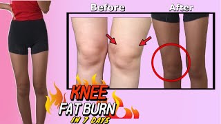 KNEE FAT BURN WORKOUT 🔥 get TONED model legs