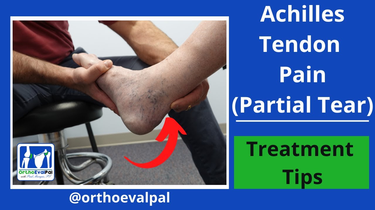 Achilles tendon pain - Osteopathy in Dulwich
