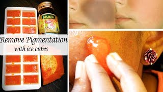 Remove Pigmentation in 1 Week | Papaya facial ice cubes at home