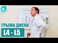 Что такое грыжа межпозвоночного диска L4 - L5