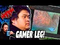 Gamer leg  tales from the internet