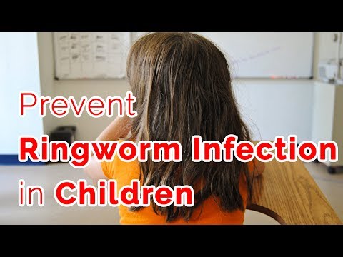 Video: 3 manieren om ringworm bij baby's te behandelen