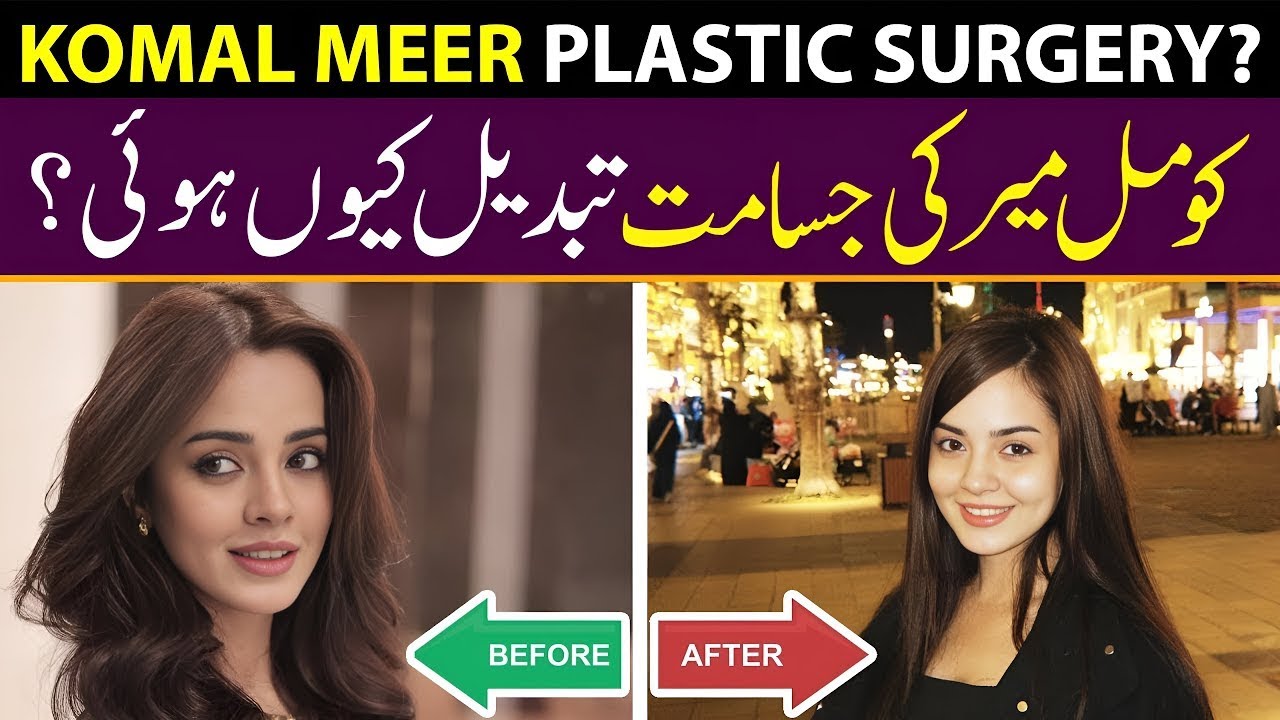 Actress Komal Meer Weight Issue Plastic Surgery
