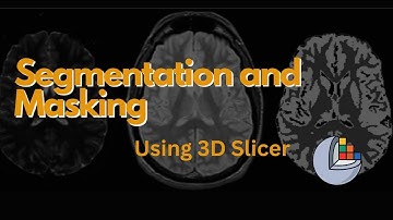 Segmentation and Masking in seconds using 3D Slicer - Hindi