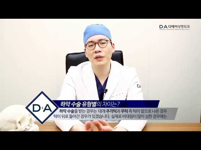 디에이성형외과 유형별 하악수술