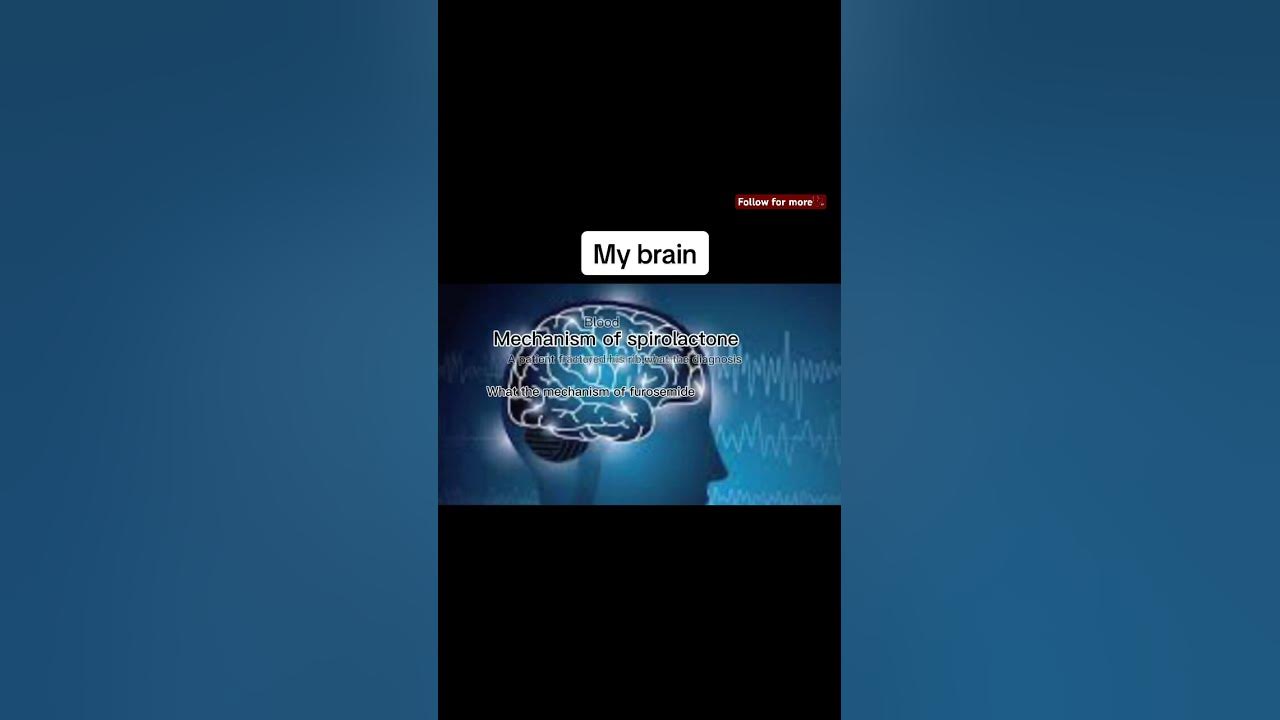 My Brain Is Paining Me shorts medicalstudent medical YouTube my-brain-is-paining-me-shorts-medicalstudent-medical-youtube