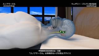 スノアサークル　SnoreCircle Japanese