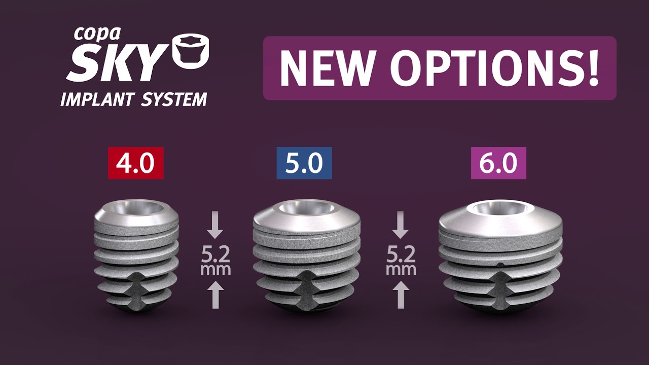 copaSKY - NEW OPTIONS zahnmedizinische fachangestellte gehalt