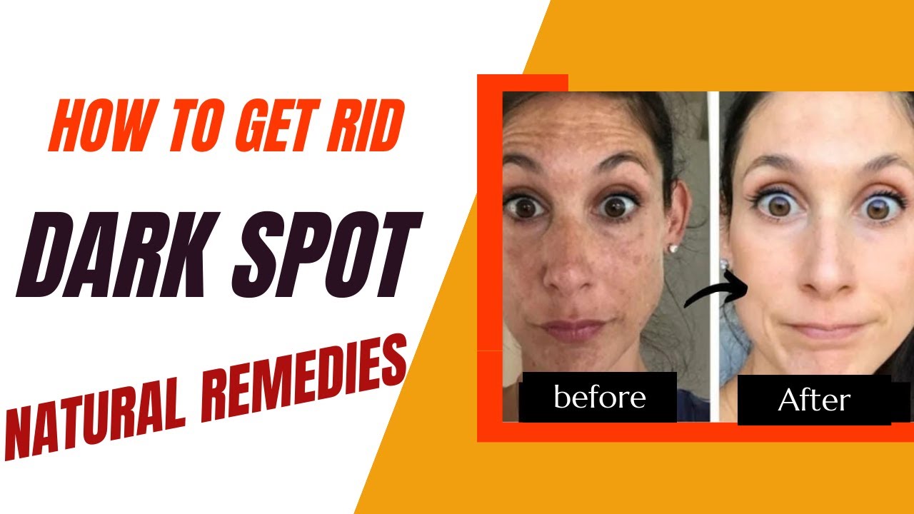 Learn about Turmeric,it's health benefits,amount of turmeric is safe to consume and how to use it .