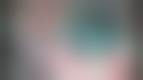 SICS Phaco-section using wire vectis and Sinskey