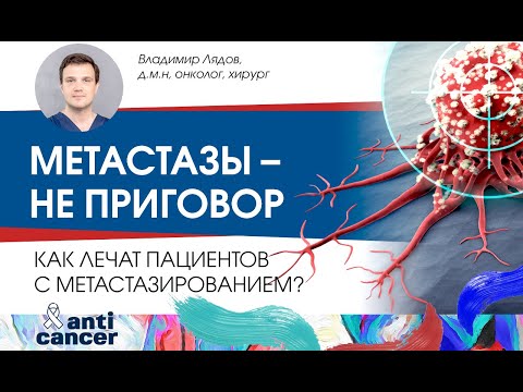 Метастазы – не приговор. Как лечат пациентов с метастазированием?