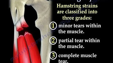 Hamstring Injuries, symptoms, diagnosis and treatment