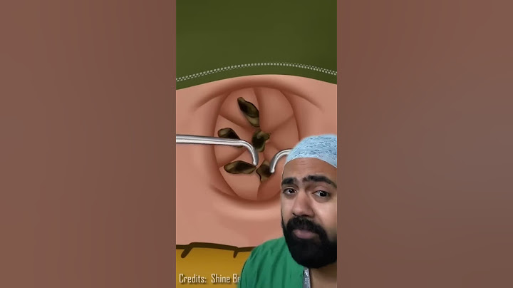 Doctor Reacts To Lost Baggage In Bellybutton