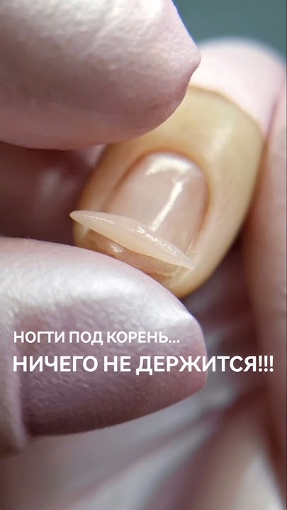 Ногти под корень. Ничего не носится. Не могу отрастить. Укрепление ...