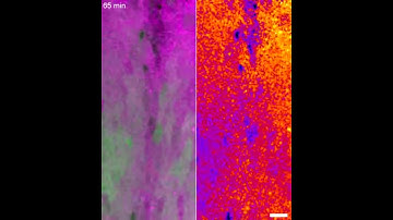 Caspase activity and cell elimination in the pupal notum