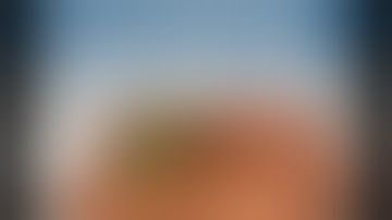 Full Laparoscopic Cholecystectomy | Safe Gallbladder Surgery with Critical View of Safety