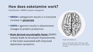 Esketamine Basics, Part I