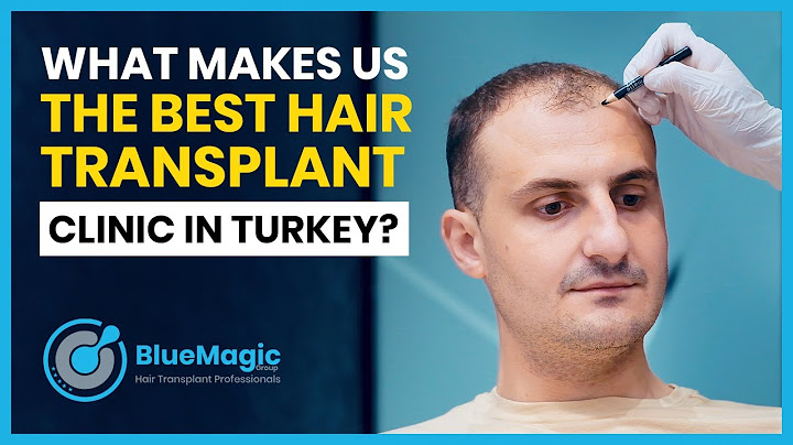 Best hair transplant clinic turkey reviews năm 2024