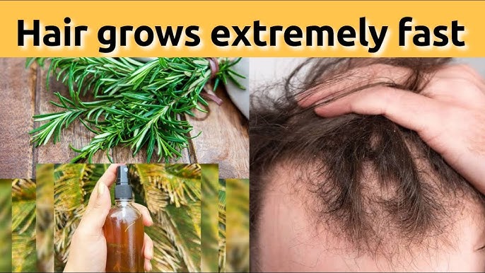 150 times stronger than onion and garlic!!! Hair grows extremely fast!!!  rosemary for hair growth - YouTube