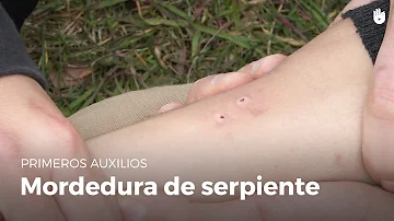 ¿Cómo sé si me ha mordido una serpiente?